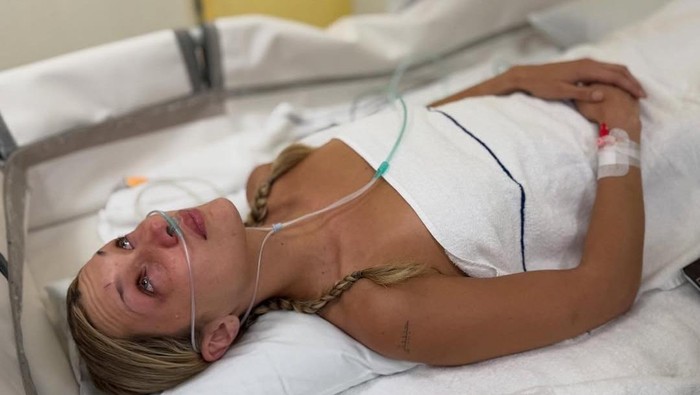 1758346148233-bella-hadid-sakit-1758329199519_169