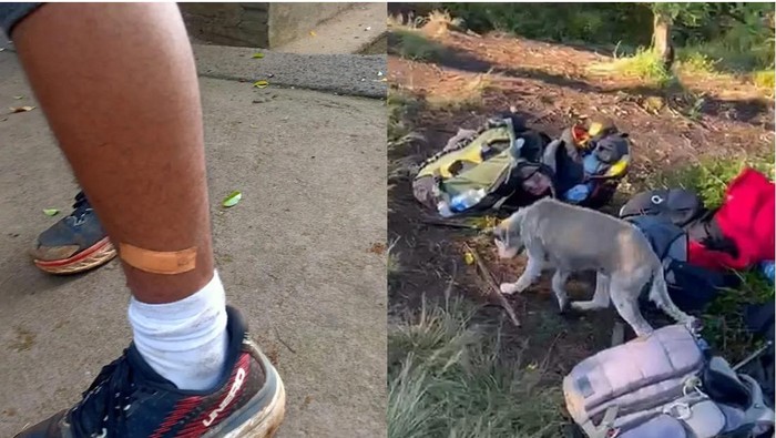 1758519196158-anjing-liar-yang-diduga-rabies-menggigit-belasan-pendaki-di-jalur-pendakian-gunung-batukaru-tabanan-minggu-2192025-1758454084158_169