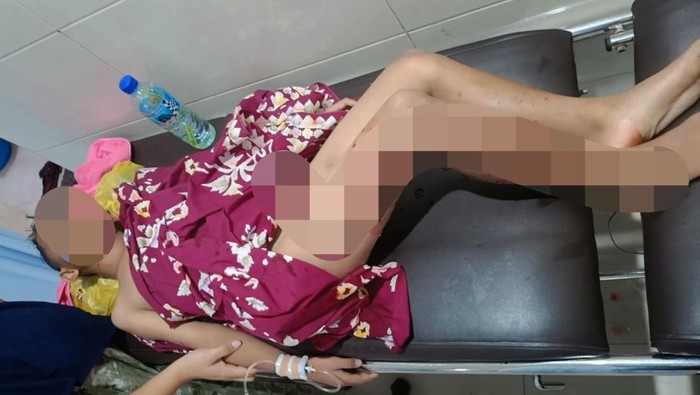 1758562113729-muhamad-rizki-alfarido-9-terbaring-di-puskesmas-setelah-diserang-anjing-liar-di-desa-terara-lombok-timur-ntb-senin-2292025-dok-1758552183670_169