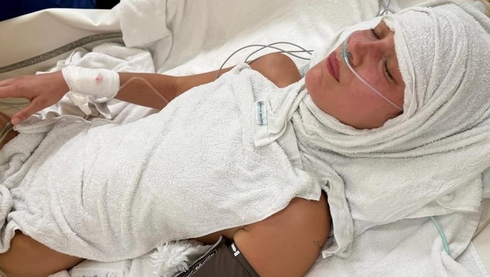 1759085304016-bella-hadid-sakit-1758329199462_169