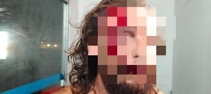 1760959841823-ed-33-wn-as-yang-menjadi-korban-penganiayaan-di-vila-desa-selong-belanak-kecamatan-praya-barat-lombok-tengah-ntb-minggu-191020-1760951683728