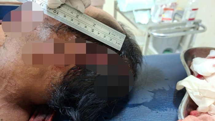 1761672640149-mj-korban-penebasan-parang-oleh-saudara-kandung-di-lombok-timur-minggu-26102025-mj-dianiaya-akibat-sengketa-tanah-warisan-dok--1761661567083_169