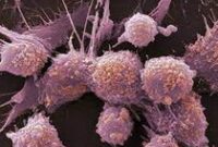 1761866398860-penyakit-kanker_43