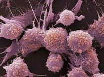 1761866398860-penyakit-kanker_43