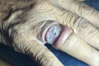 1762536470335-cincin-tertanam-di-jari-1762531305646_43